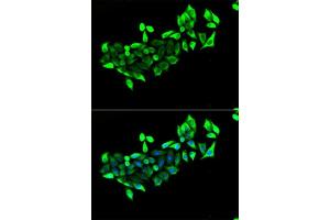 Immunofluorescence analysis of U2OS cells using FLOT1 antibody. (Flotillin 1 antibody  (AA 128-427))
