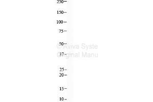 Host:  Rabbit  Target Name:  FUS  Sample Type:  Human 293T cell lysate  Antibody Dilution:  1. (FcRn antibody  (N-Term))