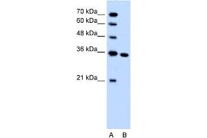 WB Suggested Anti-SLC25A29 Antibody Titration:  1. (SLC25A29 antibody  (C-Term))