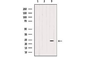 Western blot analysis of extracts from various samples, using BORG2 Antibody. (CDC42EP3 antibody  (Internal Region))