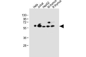 All lanes : Anti-PDCD4 Antibody (Center) at 1:2000 dilution Lane 1: Hela whole cell lysate Lane 2: Jurkat whole cell lysate Lane 3: HepG2 whole cell lysate Lane 4: Mouse thymus tissue lysate Lane 5: Rat thymus tissue lysate Lysates/proteins at 20 μg per lane. (PDCD4 antibody  (AA 121-149))