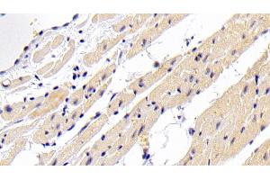 Detection of BMP2 in Rabbit Cardiac Muscle Tissue using Polyclonal Antibody to Bone Morphogenetic Protein 2 (BMP2) (BMP2 antibody  (AA 284-388))