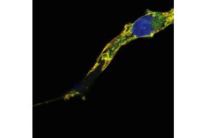 Immunocytochemistry analysis of colocalization of R-Ras2/TC21 signal (red) and GFP signal (green) in COS cells transfected with R-Ras2/TC21-GFP construct, after fixation and permeabilization. (RRAS2 antibody)