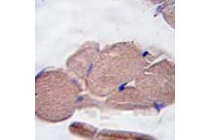 Image no. 2 for anti-Myostatin (MSTN) (N-Term) antibody (ABIN357462) (MSTN antibody  (N-Term))
