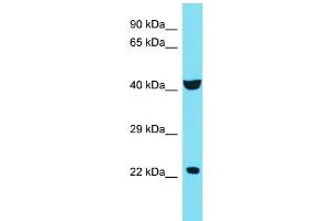 Host: Rabbit Target Name: C4orf51 Sample Type: 721_B Whole Cell lysates Antibody Dilution: 1. (C4ORF51 antibody  (C-Term))