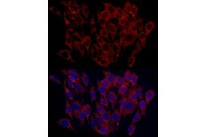 Immunofluorescence analysis of C6 cells using SURF4 Rabbit pAb (ABIN7270650) at dilution of 1:100 (40x lens). (Surfeit 4 antibody  (AA 50-150))