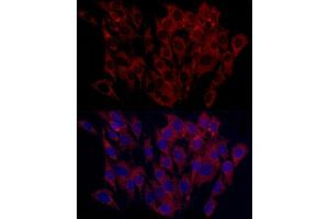 Immunofluorescence analysis of C6 cells using SURF4 Rabbit pAb (ABIN7270650) at dilution of 1:100 (40x lens). (Surfeit 4 antibody  (AA 50-150))