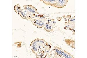 Immunohistochemistry of paraffin embedded mouse duodenum using MAL2 (ABIN7074549) at dilution of 1: 700 (400x lens)