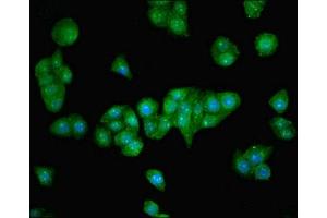 Immunofluorescent analysis of PC-3 cells using ABIN7176445 at dilution of 1:100 and Alexa Fluor 488-congugated AffiniPure Goat Anti-Rabbit IgG(H+L) (ZNF624 antibody  (AA 127-327))