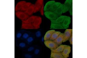 ABIN6254906 and ABIN6276287 staining Hela cells(30 min of UV treatment) by IF/ICC. (alpha Fetoprotein antibody  (C-Term))