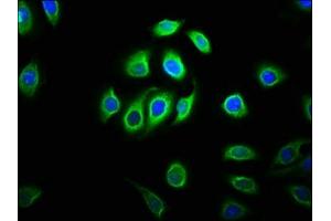 Immunofluorescence staining of A549 cells with ABIN7160437 at 1:133, counter-stained with DAPI. (Chromosome 11open Reading Frame 9 (C11orf9) (AA 843-1004) antibody)