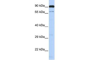 WB Suggested Anti-CTCFL Antibody Titration:  0. (CTCFL antibody  (N-Term))