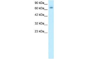 PARP2 antibody used at 1. (PARP2 antibody)