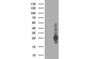 HEK293T cells were transfected with the pCMV6-ENTRY control (Left lane) or pCMV6-ENTRY CXorf26 (Right lane) cDNA for 48 hrs and lysed. (CXorf26 antibody)