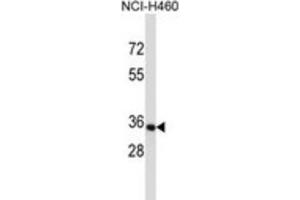 Western Blotting (WB) image for anti-Olfactory Receptor, Family 14, Subfamily C, Member 36 (OR14C36) antibody (ABIN2997522) (OR14C36 antibody)