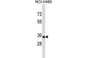 Western Blotting (WB) image for anti-Olfactory Receptor, Family 14, Subfamily C, Member 36 (OR14C36) antibody (ABIN5017126) (OR14C36 antibody)