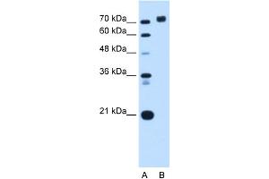 WB Suggested Anti-PTPRN Antibody Titration:  0. (PTPRN antibody  (Middle Region))