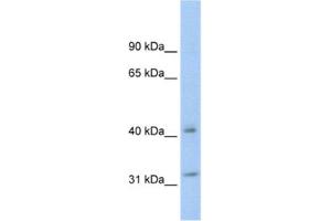 Western Blotting (WB) image for anti-14-3-3 theta (YWHAQ) antibody (ABIN2463667)