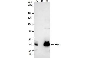 Immunoprecipitation (IP) image for anti-BMI1 Polycomb Ring Finger Oncogene (BMI1) (Center) antibody (ABIN2855259)