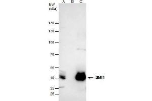 IP Image Bmi1 antibody immunoprecipitates Bmi1 protein in IP experiments.
