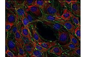 Immunofluorescence (IF) image for anti-Son of Sevenless Homolog 1 (SOS1) antibody (ABIN238504) (SOS1 antibody)