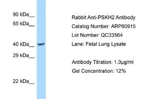 Western Blotting (WB) image for anti-Protein Serine Kinase H2 (PSKH2) (N-Term) antibody (ABIN2788622) (PSKH2 antibody  (N-Term))