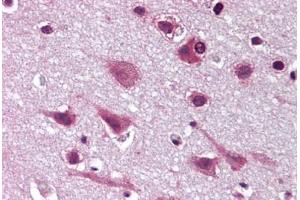 Human Brain, Cortex (formalin-fixed, paraffin-embedded) stained with MAPK9 antibody ABIN293094 at 20 ug/ml followed by biotinylated goat anti-rabbit IgG secondary antibody ABIN481713, alkaline phosphatase-streptavidin and chromogen. (JNK2 antibody  (N-Term))