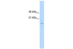CENPA antibody used at 1. (CENPA antibody  (N-Term))