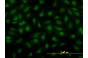 Immunofluorescence of monoclonal antibody to PSCD3 on HeLa cell. (Cytohesin 3 antibody  (AA 1-180))