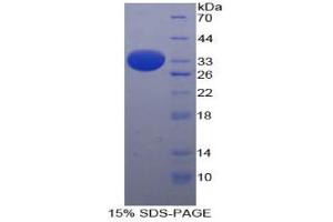 SDS-PAGE analysis of Human ARRB1 Protein. (beta Arrestin 1 Protein)