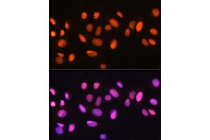 Immunofluorescence analysis of U-2 OS cells using Ku70 Rabbit mAb (ABIN7271407) at dilution of 1:100 (40x lens). (XRCC6 antibody)