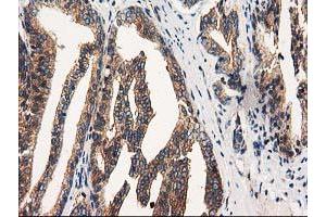 Image no. 1 for anti-Striatin Interacting Protein 1 (STRIP1) antibody (ABIN1498205) (STRIP1 antibody)