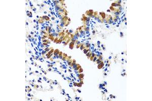 Immunohistochemistry of paraffin-embedded mouse lung using CAMLG antibody (ABIN6129359, ABIN6137896, ABIN6137897 and ABIN6217819) at dilution of 1:100 (40x lens). (CAMLG antibody  (AA 1-190))