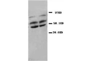 Western blot analysis of rat kidney tissue lysis using PP2A antibody