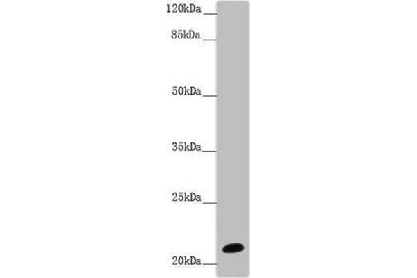 NCALD antibody  (AA 1-193)