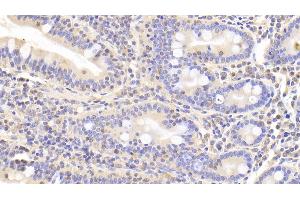 Detection of LDHB in Human Small intestine Tissue using Polyclonal Antibody to Lactate Dehydrogenase B (LDHB) (LDHB antibody  (AA 1-334))