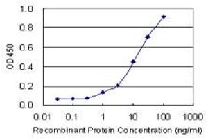 Detection limit for recombinant GST tagged CTBP1 is 0. (CTBP1 antibody  (AA 1-429))