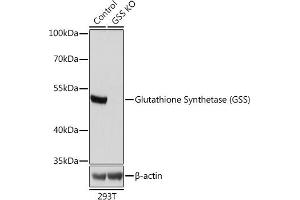 Western blot analysis of extracts from normal (control) and Glutathione Synthetase (Glutathione Synthetase (GSS)) knockout (KO) 293T cells, using Glutathione Synthetase (Glutathione Synthetase (GSS)) antibody (ABIN7267451) at 1:1000 dilution. (Glutathione Synthetase antibody  (AA 373-474))
