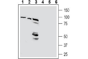 Western blot analysis of human Jurkat T-cell leukemia cell line lysates (lanes 1 and 4), human HepG2 hepatocellular carcinoma cell line lysate (lanes 2 and 5) and human Colo-205 colon carcinoma cell line lysates (lanes 3 and 6):1-3. (ATPase beta 1, Na, K Peptide)