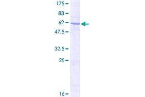 SFXN3 Protein (AA 1-325) (GST tag)