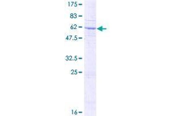 SFXN3 Protein (AA 1-325) (GST tag)