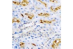 Immunohistochemical analysis of LC3B staining in rat kidney formalin fixed paraffin embedded tissue section. (LC3B antibody)