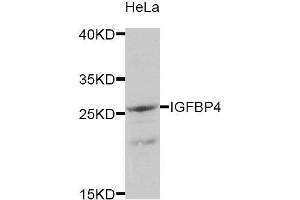 Western Blotting (WB) image for anti-Insulin-Like Growth Factor Binding Protein 4 (IGFBP4) antibody (ABIN1875429) (IGFBP4 antibody)