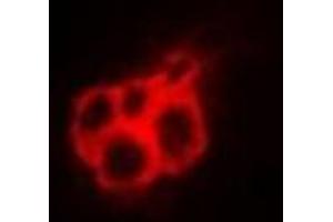 Immunofluorescent analysis of Annexin A4 staining in A549 cells. (Annexin IV antibody)