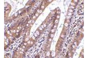 Immunohistochemistry of CIDE-B in human small intestine tissue with CIDE-B antibody at 5 μg/ml. (CIDEB antibody  (C-Term))