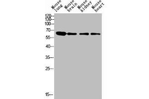 Western blot analysis of human blood lysate, antibody was diluted at 1000. (LGALS3BP antibody  (AA 100-160))