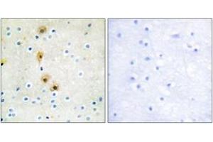 Immunohistochemistry analysis of paraffin-embedded human brain tissue, using Akt (Ab-326) Antibody. (AKT1 antibody  (AA 292-341))