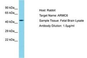 Image no. 1 for anti-Armadillo Repeat Containing 6 (ARMC6) (AA 157-206) antibody (ABIN6750737) (ARMC6 antibody  (AA 157-206))