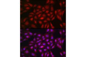 Immunofluorescence analysis of U2OS cells using PPARγ Rabbit pAb (ABIN3020843, ABIN3020844, ABIN3020845, ABIN1513399 and ABIN6213752) at dilution of 1:200 (40x lens). (PPARG antibody  (AA 50-150))