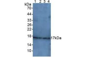 Figure. (p21 antibody  (AA 1-164))
